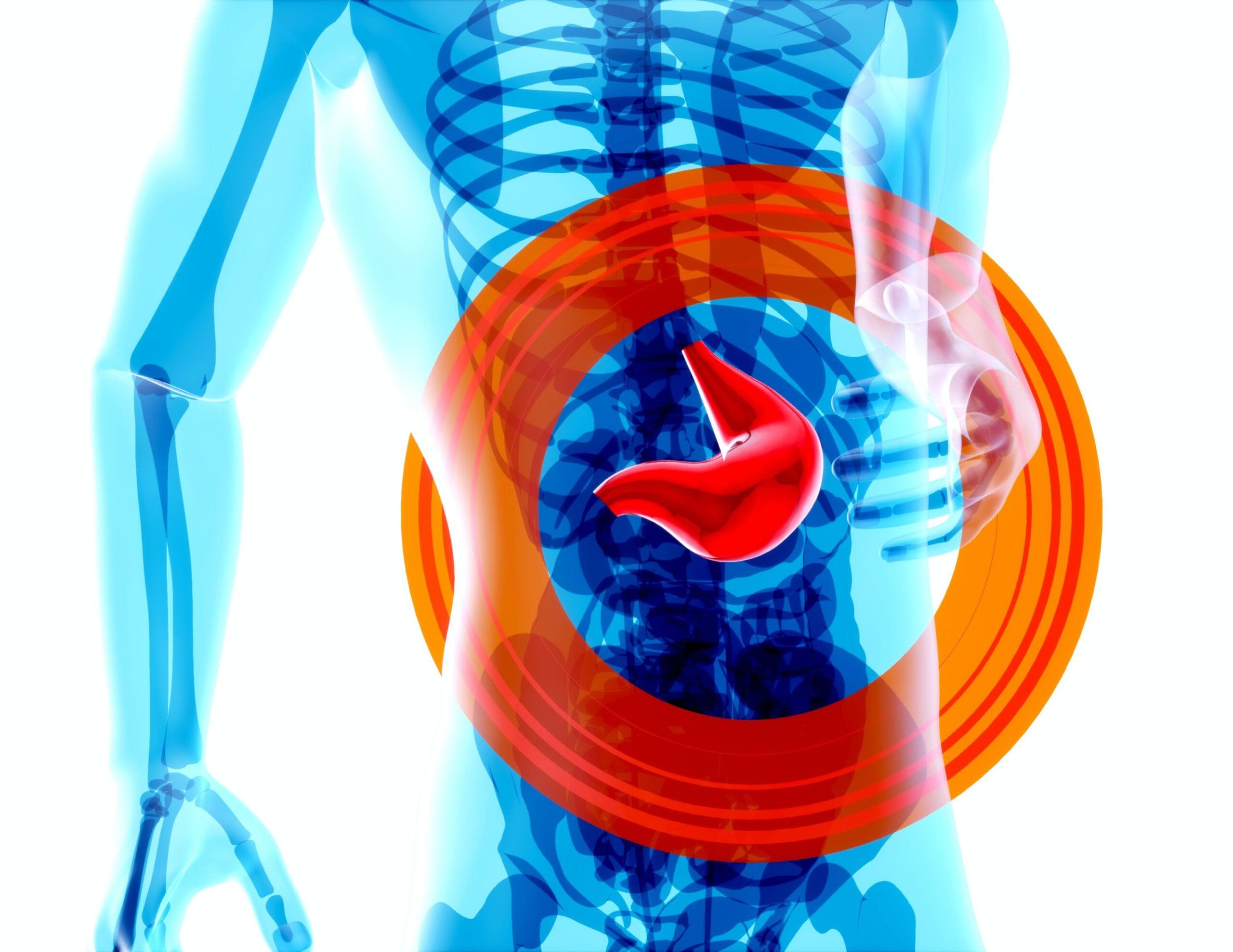 Kidney disease Chronic kidney disease Dialysis treatment